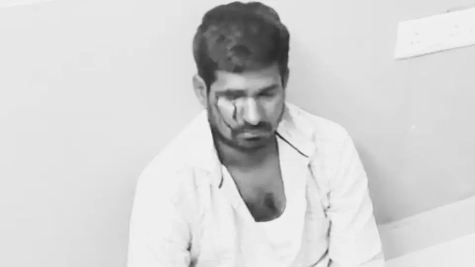 Telangana farmer alleges police brutality in Siddipet